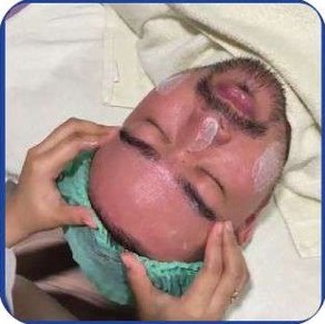 Facial Sebum Control Exclusive