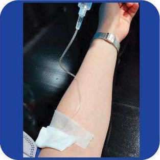 lnjection Therapy Acne